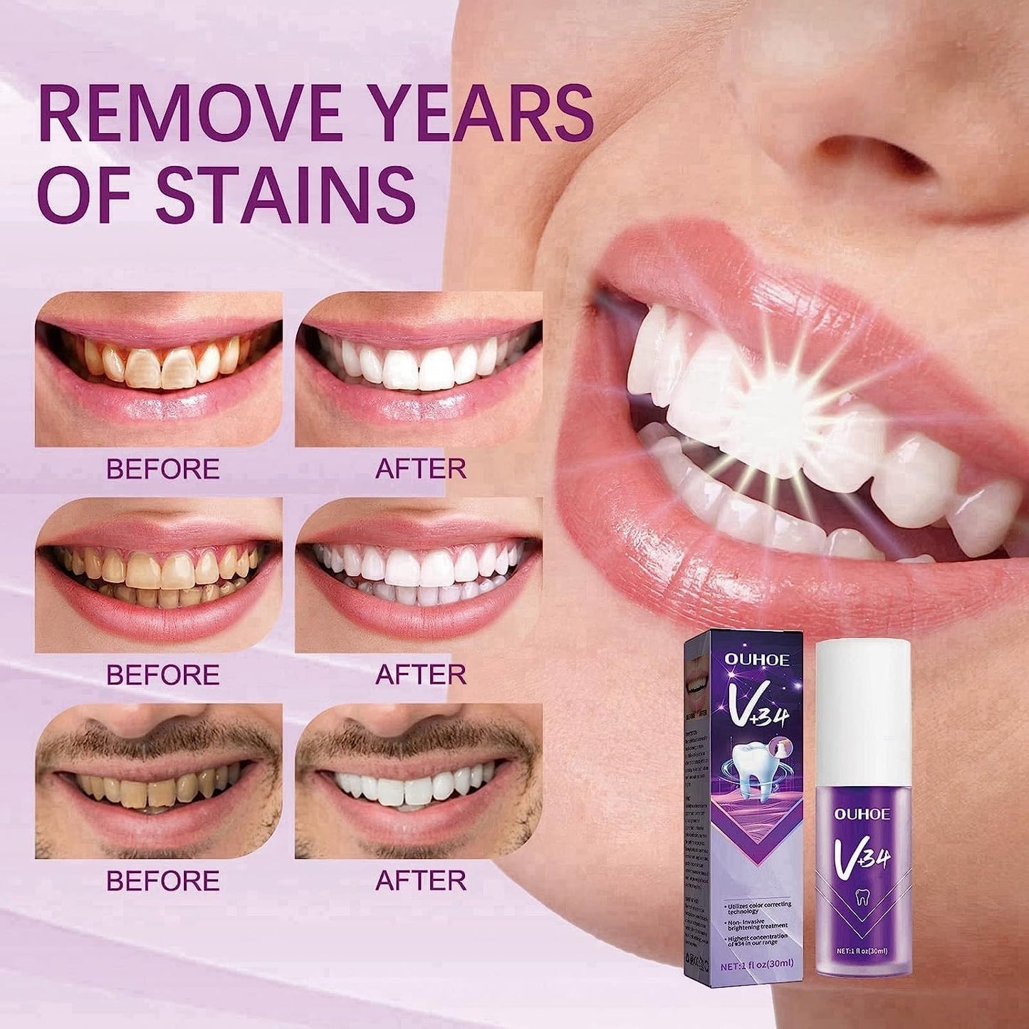 VioBright™ Purple Toothpaste For Teeth Whitening