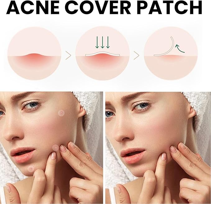 AcniFix™ Acne Cover Patch (72 Pieces)
