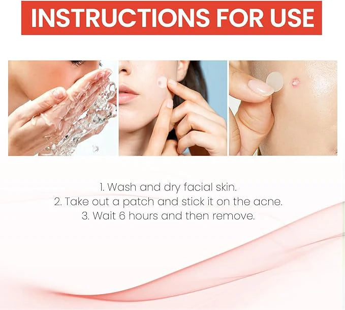 AcniFix™ Acne Cover Patch (72 Pieces)