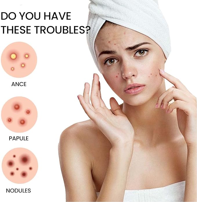 AcniFix™ Acne Cover Patch (72 Pieces)