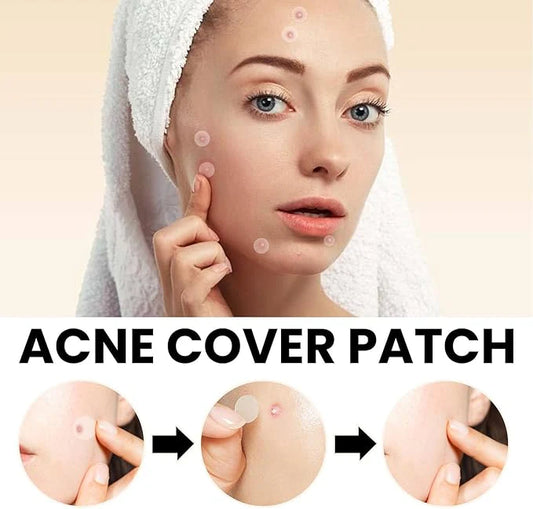 AcniFix™ Acne Cover Patch (72 Pieces)